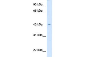 WB Suggested Anti-cad Antibody Titration:  0. (CAD Antikörper  (Middle Region))