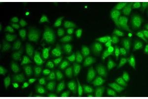 Immunofluorescence analysis of HeLa cells using AKR1A1 Polyclonal Antibody (AKR1A1 Antikörper)