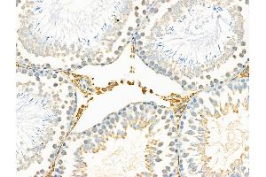 ABIN6258931 and ABIN6275368 at 1/100 staining Rat testis tissue by IHC-P.