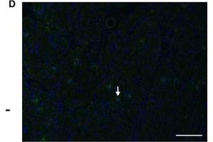 Immunofluorescence (Paraffin-embedded Sections) (IF (p)) image for anti-Chemokine (C-X-C Motif) Receptor 3 (CXCR3) (AA 301-367) antibody (ABIN678653)