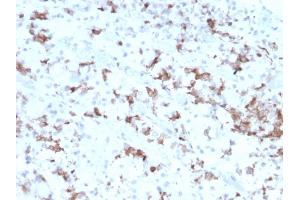 Formalin-fixed, paraffin-embedded human Pituitary stained with Prolactin Mouse Monoclonal Antibody (PRL/2641). (Prolactin Antikörper  (AA 63-201))