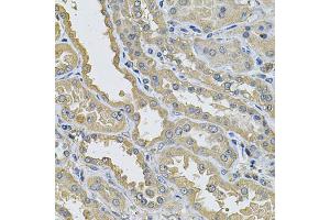 Immunohistochemistry of paraffin-embedded human kidney using PPID Antibody (ABIN5974177) at dilution of 1/100 (40x lens). (PPID Antikörper)