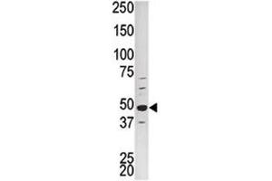 Western blot analysis of PCTAIRE1 antibody and HepG2 lysate (CDK16 Antikörper  (AA 357-386))