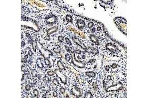 IHC analysis of TBX18 using anti-TBX18 antibody (ABIN7599494).