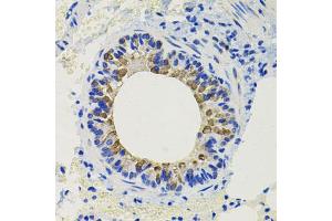 Immunohistochemistry of paraffin-embedded mouse lung using CALB2 antibody. (Calretinin Antikörper)