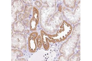 ABIN6266891 at 1/100 staining human kidney tissue sections by IHC-P. (NRIP2 Antikörper  (N-Term))