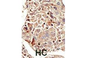 Immunohistochemistry (IHC) image for anti-Activin Receptor Type I (ACRV1) antibody (ABIN3003503)