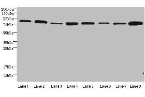 Western blot All lanes: Protein argonaute-2 antibody at 2 μg/mL Lane 1: A549 whole cell lysate Lane 2: Jurkats whole cell lysate Lane 3: MCF-7 whole cell lysate Lane 4: HepG2 whole cell lysate Lane 5: Raw264. (AGO2 Antikörper  (AA 517-818))