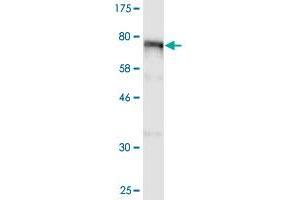 Western Blot detection against Immunogen (98. (ALOX15 Antikörper  (AA 1-662))