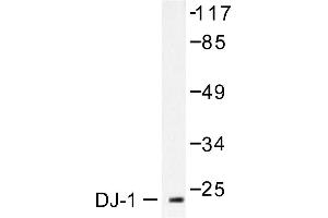 Image no. 1 for anti-Parkinson Protein 7 (PARK7) antibody (ABIN265384) (PARK7/DJ1 Antikörper)