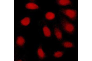 ABIN6269077 staining Hela cells by ICC/IF. (c-MYC Antikörper  (N-Term))