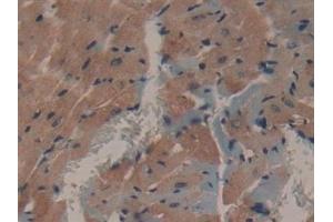 Immunohistochemistry (IHC) image for anti-Microtubule-Associated Protein 1A (MAP1A) (AA 2552-2759) antibody (ABIN7431635)
