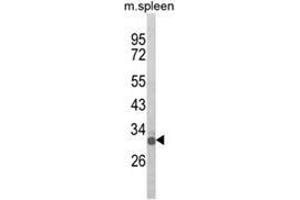 Western blot analysis of OLIG3 Antibody (Center) in mouse spleen tissue lysates (35ug/lane). (OLIG3 Antikörper  (Middle Region))