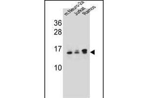 UBE2E2 Antibody (N-term) (ABIN657745 and ABIN2846729) western blot analysis in mouse Neuro-2a,Jurkat,Ramos cell line lysates (35 μg/lane). (UBE2E2 Antikörper  (N-Term))