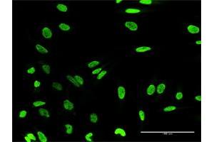 Immunofluorescence of purified MaxPab antibody to HN1L on HeLa cell. (HN1L Antikörper  (AA 1-190))