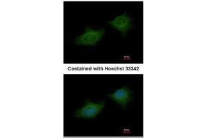ICC/IF Image Immunofluorescence analysis of methanol-fixed HeLa, using MMP3, antibody at 1:200 dilution. (MMP3 Antikörper)