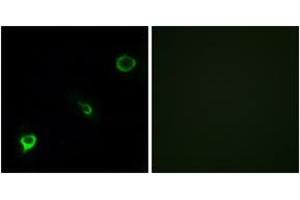 Immunofluorescence analysis of COS7 cells, using TYK2 (Ab-1054) Antibody. (TYK2 Antikörper  (AA 1020-1069))