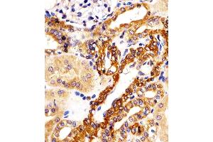 (ABIN6242941 and ABIN6578201) staining KIF22 in human kidney tissue sections by Immunohistochemistry (IHC-P - paraformaldehyde-fixed, paraffin-embedded sections). (KIF22 Antikörper  (AA 423-456))