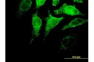 Immunofluorescence of purified MaxPab antibody to IFNA4 on HeLa cell. (IFNA4 Antikörper  (AA 1-189))