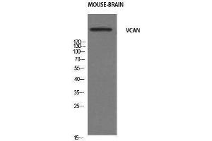 Western Blotting (WB) image for anti-Versican (Vcan) (N-Term) antibody (ABIN3187467) (Versican Antikörper  (N-Term))