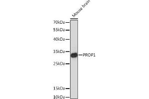 Western blot analysis of extracts of Mouse brain, using PROP1 Rabbit pAb (ABIN7269568) at 1:1000 dilution. (PROP1 Antikörper  (AA 50-150))