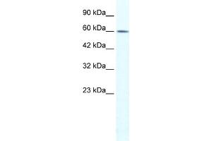 WB Suggested Anti-TRIM3 Antibody Titration:  1. (TRIM3 Antikörper  (N-Term))