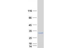 Western Blotting (WB) image for Four and A Half LIM Domains 2 (FHL2) (Transcript Variant 2) protein (Myc-DYKDDDDK Tag) (ABIN2721141)