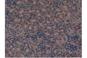 IHC-P analysis of Mouse Kidney Tissue, with DAB staining. (FLT4 Antikörper  (AA 30-326))