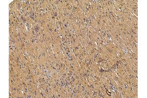 ABIN7094625 and ABIN7098675 at 1/100 staining Rat heart tissue by IHC-P.