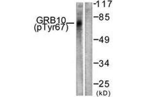 Western blot analysis of extracts from NIH-3T3 cells treated with Insulin 0. (GRB10 Antikörper  (pTyr67))