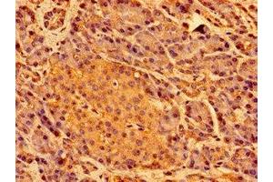 Immunohistochemistry of paraffin-embedded human pancreatic tissue using ABIN7169441 at dilution of 1:100 (SHE Antikörper  (AA 2-162))