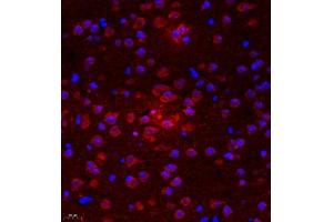 Immunofluorescence of paraffin embedded mouse brain using UTS2 (ABIN7076162) at dilution of 1:2000 (400x lens) (Urotensin 2 Antikörper)
