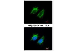 ICC/IF Image Immunofluorescence analysis of paraformaldehyde-fixed HeLa, using Inhibin beta-A , antibody at 1:200 dilution. (INHBA Antikörper  (C-Term))