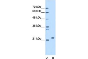 Western Blotting (WB) image for anti-Stromal Cell Derived Factor 2 (SDF2) antibody (ABIN2463207)
