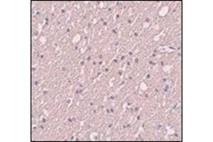 Immunohistochemistry of SIPA1L3 in human brain tissue with this product at 5 μg/ml. (SIPA1L3 Antikörper  (N-Term))