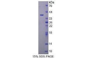 SDS-PAGE analysis of Human MYB Protein.