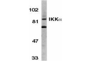 Western blot analysis of IKK alpha in Jurkat whole cell lysate with AP30405PU-N IKK alpha antibody (C3) at 1/500 dilution. (IKK alpha Antikörper  (C-Term))