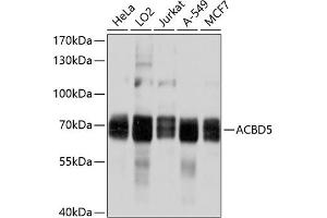 Western blot analysis of extracts of various cell lines, using  antibody (ABIN6131213, ABIN6136419, ABIN6136420 and ABIN6214901) at 1:1000 dilution. (ACBD5 Antikörper  (AA 170-440))
