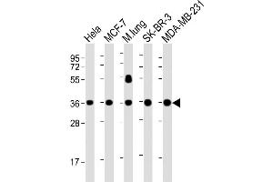 Lane 1: HeLa, Lane 2: MCF-7, Lane 3: mouse lung, Lane 4: SK-BR-3, Lane 5: MDA-MB-231 cell lysate at 20 µg per lane, probed with bsm-51380M WNT4 (1698CT540. (WNT4 Antikörper)