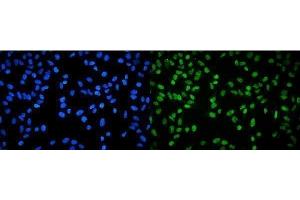 IF analysis of RPA32/RPA2 using anti-RPA32/RPA2 antibody (ABIN7601380). (RPA2 Antikörper  (AA 34-254))