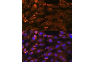 Immunofluorescence analysis of C6 cells using PTCH1 antibody (ABIN1682368, ABIN1682367, ABIN3015342, ABIN3015343 and ABIN6213997) at dilution of 1:100. (Patched 1 Antikörper  (AA 1214-1312))
