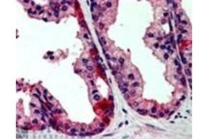 Image no. 1 for anti-TAO Kinase 3 (TAOK3) (Internal Region) antibody (ABIN374459) (TAO Kinase 3 Antikörper  (Internal Region))