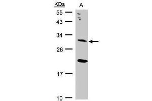 WB Image Sample(30 ug whole cell lysate) A:293T 12% SDS PAGE antibody diluted at 1:2000 (UROS Antikörper)