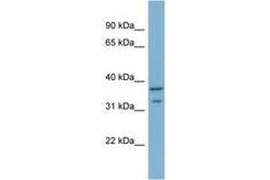 Image no. 1 for anti-Ral GEF with PH Domain and SH3 Binding Motif 2 (RALGPS2) (AA 201-250) antibody (ABIN6742101) (RALGPS2 Antikörper  (AA 201-250))