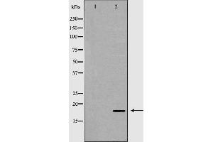 Western blot analysis of extracts of fetal brain, using THY1 antibody. (CD90 Antikörper  (Internal Region))