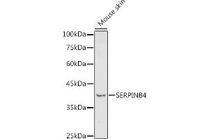 Western blot analysis of extracts of Mouse skin, using SERPINB4 antibody (ABIN7270243) at 1:1000 dilution.