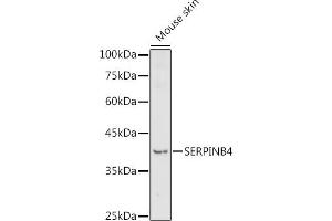Western blot analysis of extracts of Mouse skin, using SERPINB4 antibody (ABIN7270243) at 1:1000 dilution. (SERPINB4 Antikörper  (C-Term))