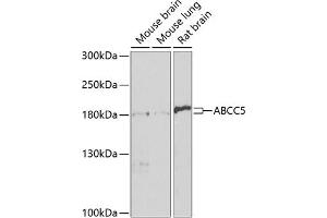 Western blot analysis of extracts of various cell lines, using  antibody (ABIN3017213, ABIN3017214, ABIN3017215 and ABIN6219998) at 1:1000 dilution. (ABCC5 Antikörper  (AA 1-179))