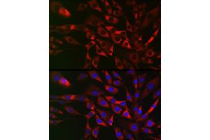 Immunofluorescence analysis of NIH/3T3 cells using TRIP2 Rabbit pAb (ABIN6129947, ABIN6149464, ABIN6149465 and ABIN6222516) at dilution of 1:50 (40x lens). (TRAF3IP2 Antikörper  (AA 1-300))