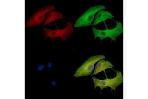 ABIN7095300 and ABIN7099357 staining  cells by IF/ICC.